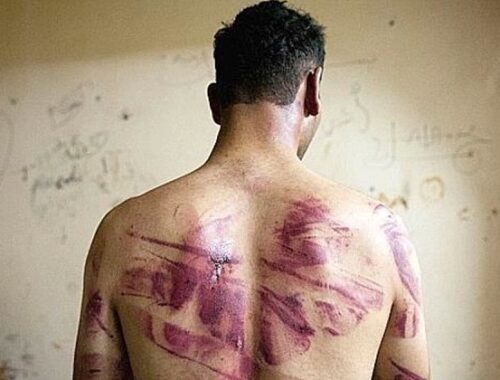 Il del 26 giugno si celebra la Giornata Internazionale per le vittime di tortura